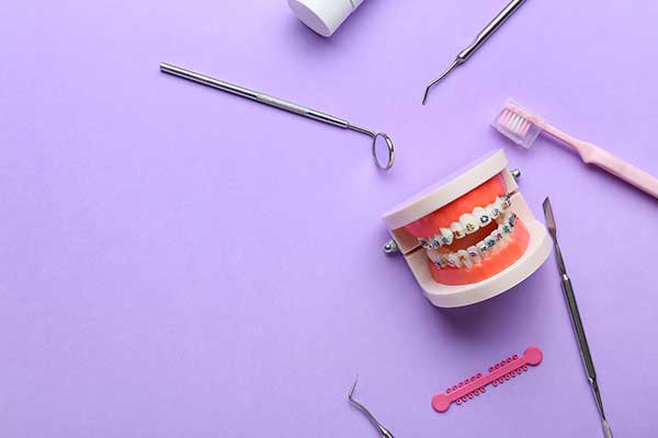 小児矯正がおすすめの方